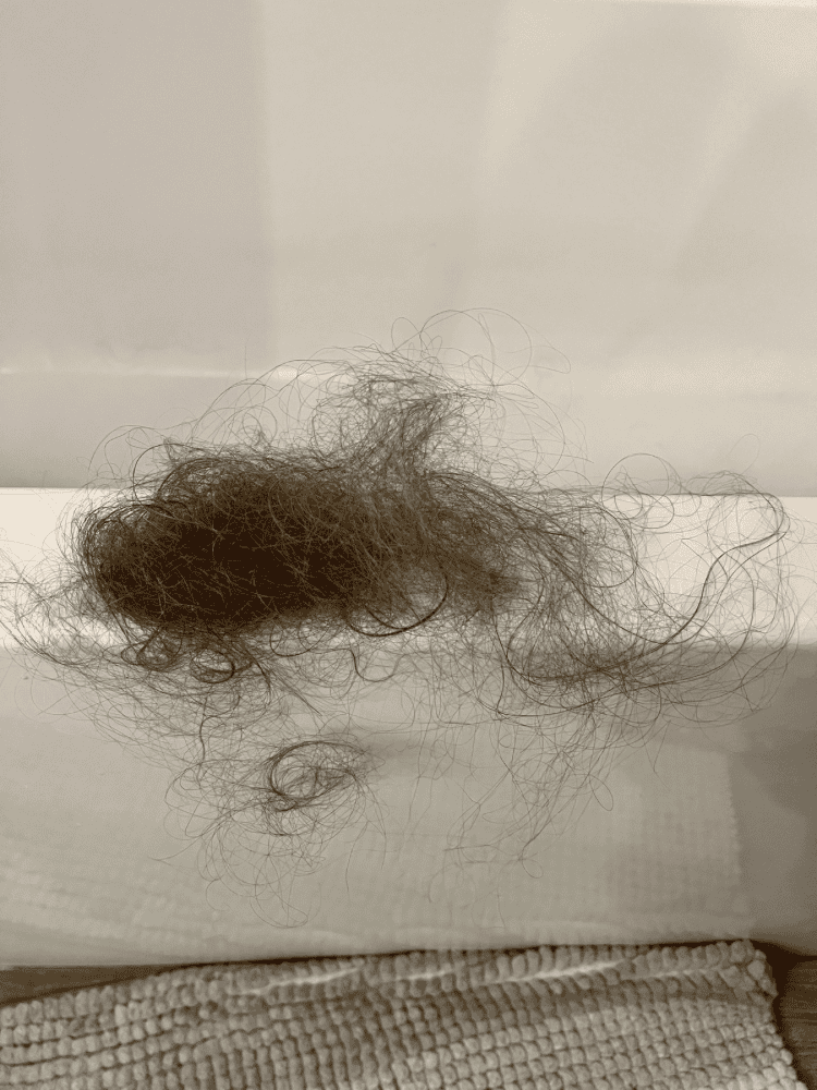 Clumps of Hair Falling Out