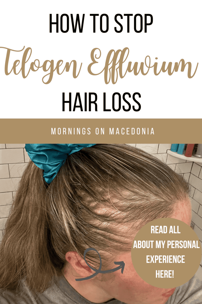 Pin For How to Stop Telogen Effluvium Hair Loss