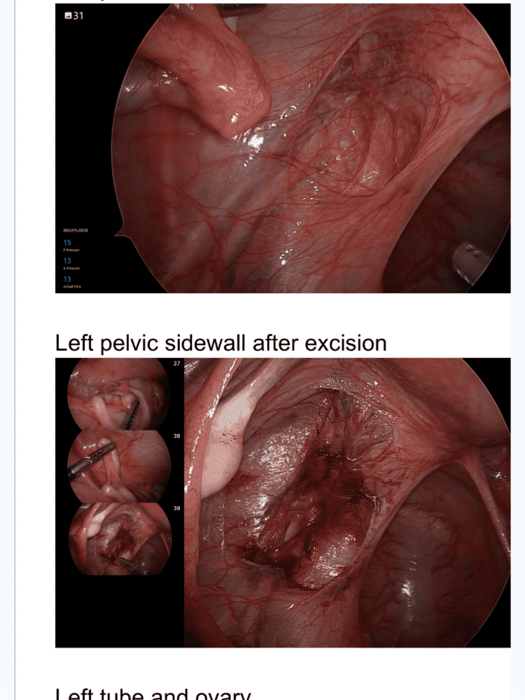 After Surgery Photos