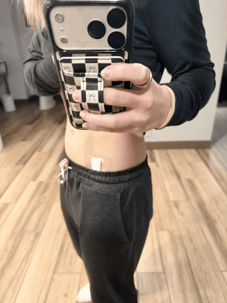 Enodmetriosis Surgery