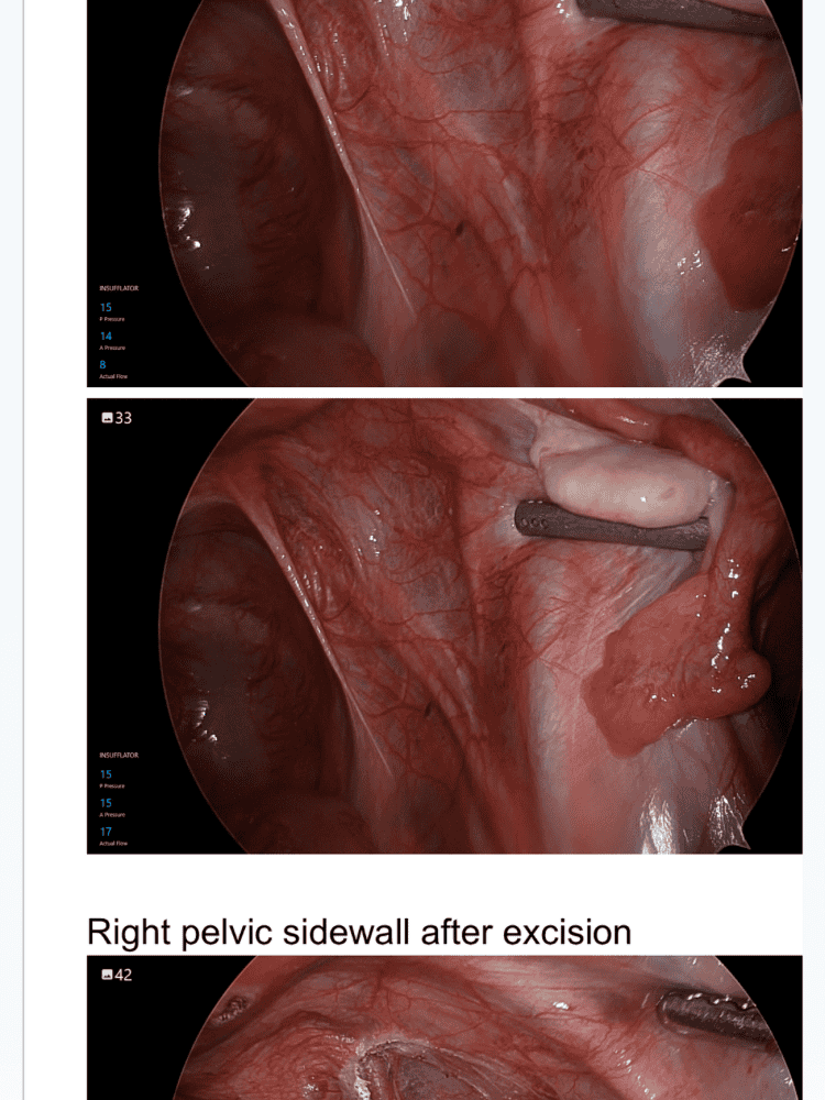 Surgical Photo