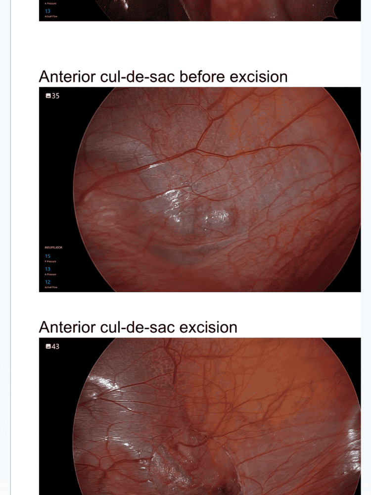 Surgical Photos